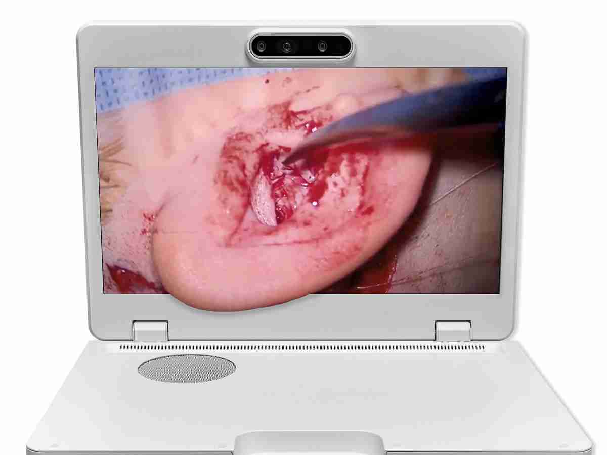 达擎之＂Heads-up 3D显微手术显示系统＂，，整合4K裸眼3D显示及眼球追踪系统，，，具备快速追踪人眼移动位置功能，，减轻医师长时间维持固定姿势的负担，，，，让医师能有更宽广清晰的3D立体视野及更舒适的姿势来执行手术。。。。